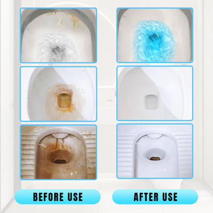 🔥Heißer Verkauf 50%🔥Effektiver konzentrierter Entkalkungs-Toilettenreinigungsstab🚽