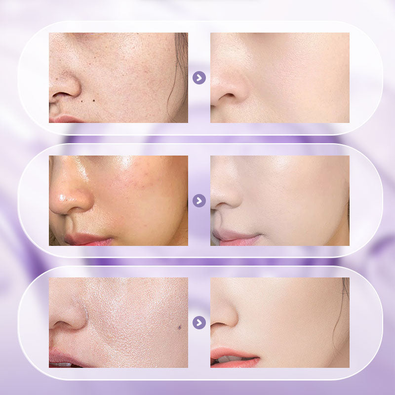 🎉Sommer-Spezialangebot🎉Alles-in-einem-Nicotinamid-Crème