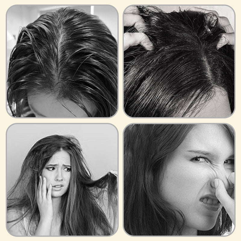 🌸Pflanzliches Shampoo zur Ölregulierung und Haarreparatur🌟