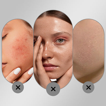 🔥Hot Sale 50% OFF🔥Bleichende und feuchtigkeitsspendende Gesichtscreme zur Beseitigung von Sommersprossen