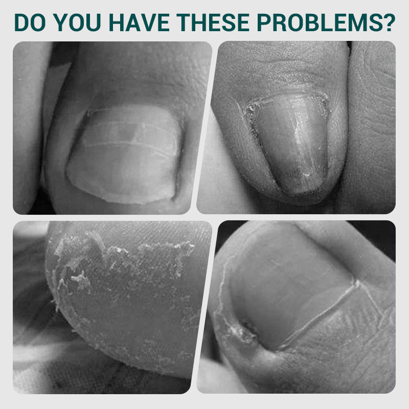 🔥2025 Heißer Verkauf - 50% Rabatt🔥 Pro gewinkelt Frühling Nagelknipser