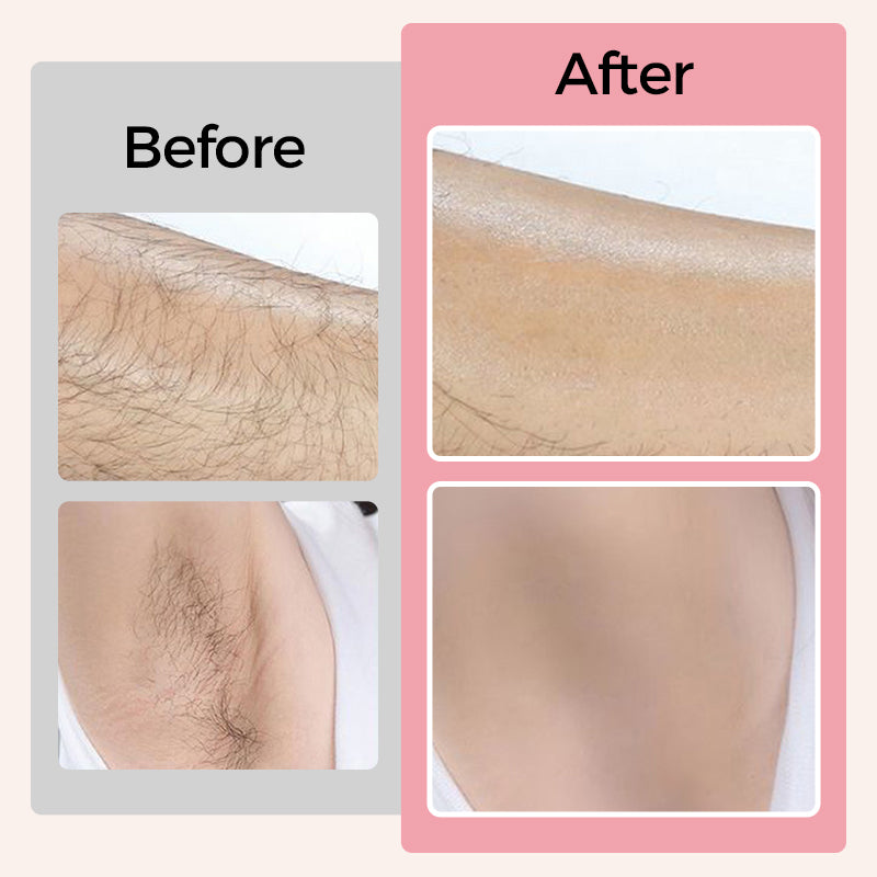 🙋‍♀️2025 Frühjahrsaktion💖Reinigendes & weichmachendes Haarentfernungs-Creme-Set