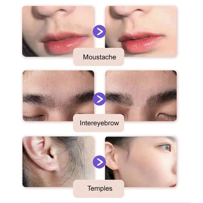 💗Kaufen Sie 1 und erhalten Sie 1 gratis💗✨Sanfte und schmerzlose Gesichtshaarentfernungscreme