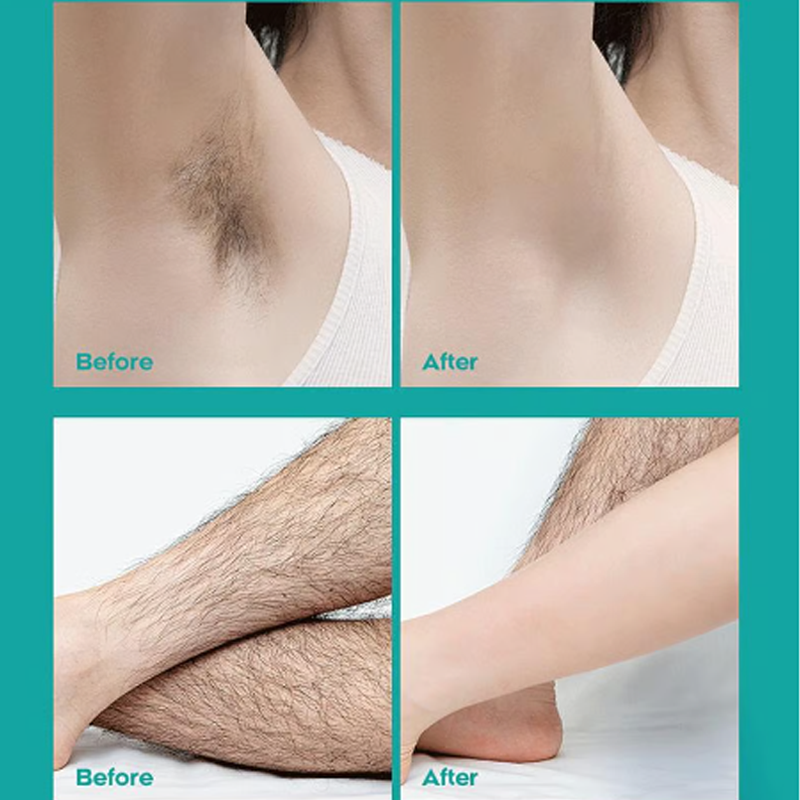 🔥  50% RABATT！！Begrenzter Verkauf - Kaufen Sie 2 und erhalten Sie 1 gratis! 🎁 Schmerzfreie Ganzkörper-Haarentfernungscreme 💧✨