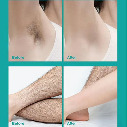 🔥  50% RABATT！！Begrenzter Verkauf - Kaufen Sie 2 und erhalten Sie 1 gratis! 🎁 Schmerzfreie Ganzkörper-Haarentfernungscreme 💧✨