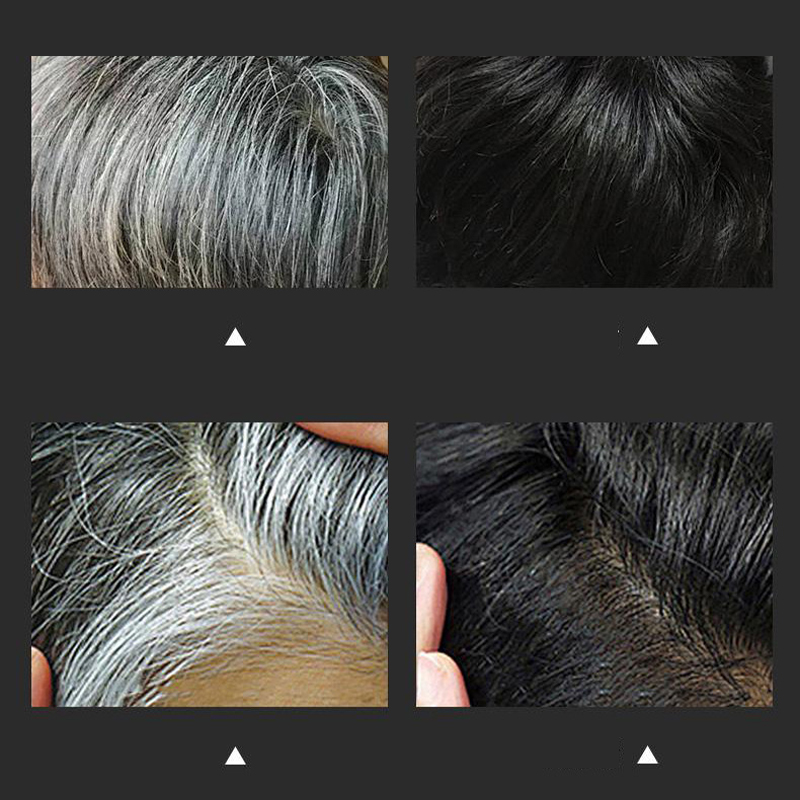 💇‍♀️ 50 % RABATT! ✨ Sicherer und tragbarer Haarfärbekamm – Einfach zu verwenden 🌟