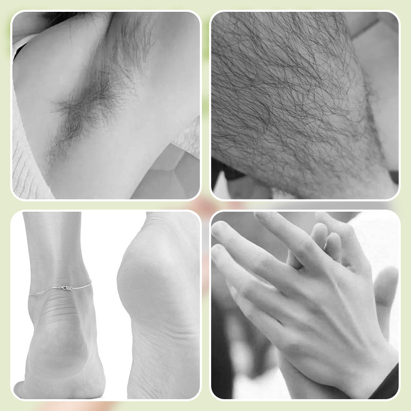 🦶2-in-1 Elektrischer Fuß Hornhaut- und Haarentferner🤩