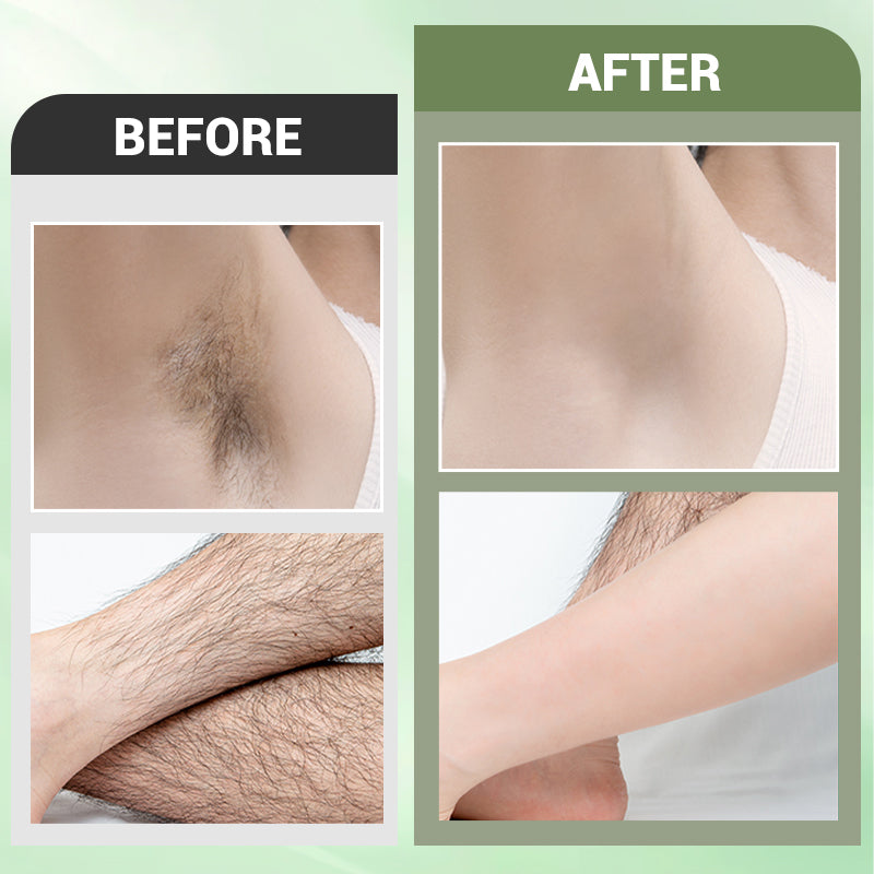 ⏳Begrenzte Zeit 50% Rabatt💥3-Teiliges Haarentfernungscreme-Set für den gesamten Körper